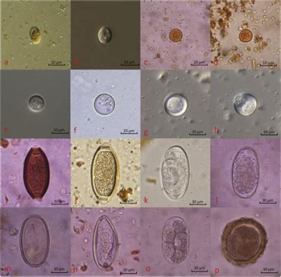  Cryptosporidium: Een Microscopische Schurk die Maagdarmstoornissen Veroorzaakt!