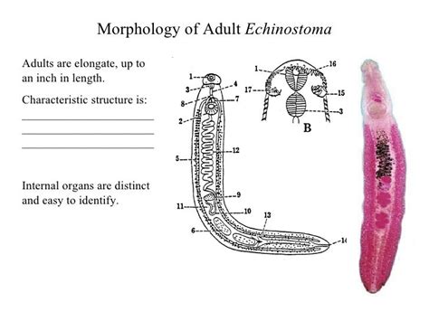  Echinostoma: Een interne parasiet met een smaak voor schelpdieren!