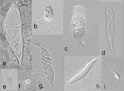  Monocercomonas! Een Microscopische Reus Met een Verrassende Eetlust