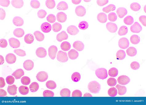  Plasmodium! De microscopische meesterbrein achter malaria die een leger van rode bloedcellen commandeert