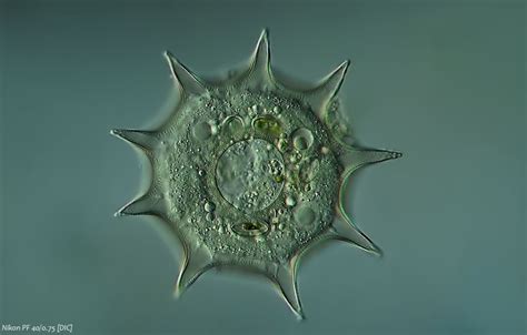  Rhizamoeba! Een Amoebozoaan Met Een Ongelofelijk Complex Leven Voor Zo'n Klein Wezentje