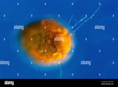  Testate Amoeba: De wonderlijke wereld van een enkelvoudig organisme met een kalkhuisje!