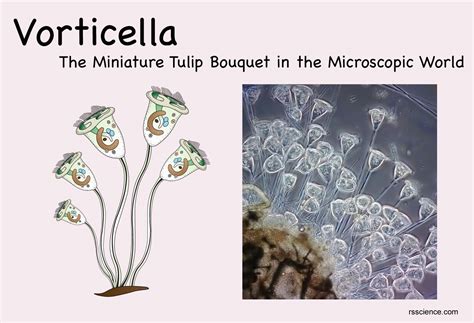   Vorticella! De Miniatuur Whirlpools Die Je Aquarium Tot Leven Wekken